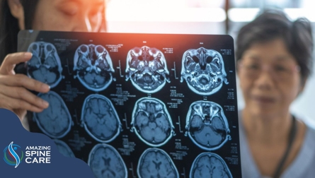 Cómo las conmociones cerebrales impactan el cerebro y el cuerpo