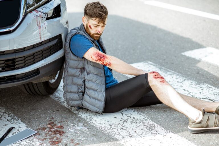 The Most Common Car Accident Injuries and How They’re Treated
